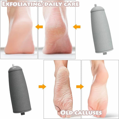 👣Smart™ Callus Remover (For Feet)